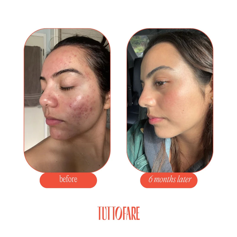 Tuttofare Roman Blue Tallow Balm 70 g | Deeply Nourishing Multi-Purpose Skin Balm